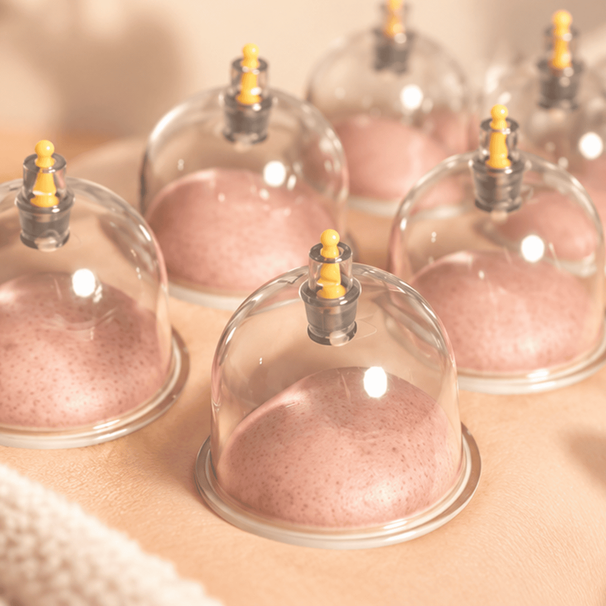 Keep Cupping – koppningsbehandlingar och koppningsmassage